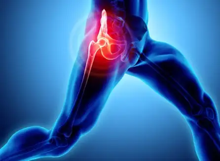 Hip Pain After Running 2