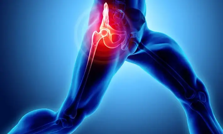 Hip Pain After Running 2